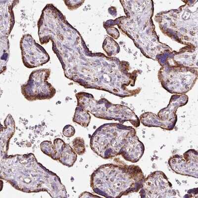 Immunohistochemistry-Paraffin: Neurofibromin 1 Antibody [NBP2-37914]