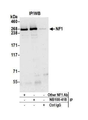 Immunoprecipitation: Neurofibromin 1 Antibody [NB100-418]