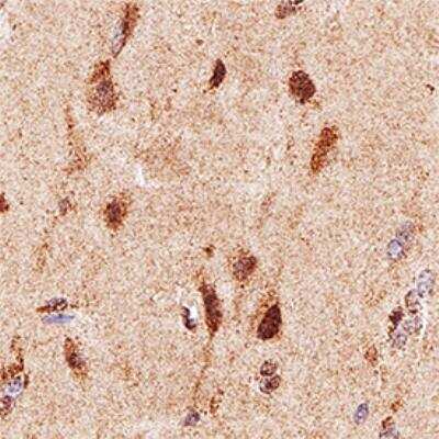 Immunohistochemistry-Paraffin: Neurofibromin 1 Antibody (McNFn27a) - BSA Free [NB300-153]