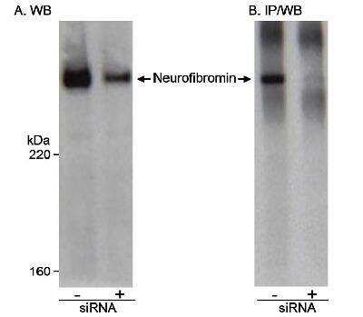 Western Blot: Neurofibromin 1 Antibody [NB100-418]
