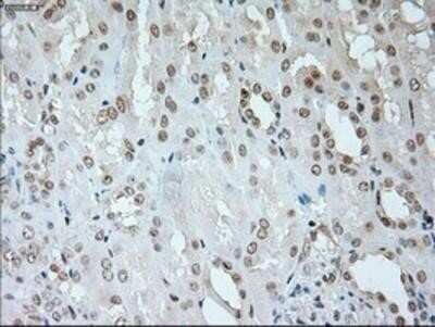 Immunohistochemistry: Neurogenin-1 Antibody (OTI3F9) - Azide and BSA Free [NBP2-72948]