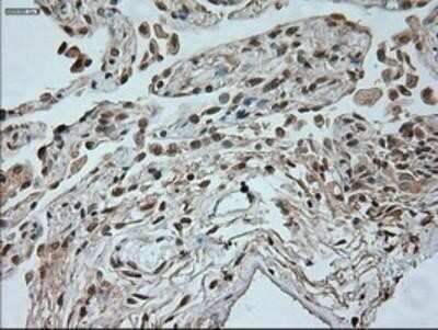 Immunohistochemistry: Neurogenin-1 Antibody (OTI3F9) - Azide and BSA Free [NBP2-72948]