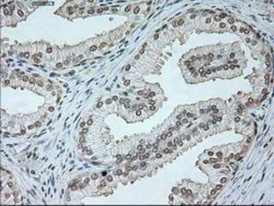 Immunohistochemistry: Neurogenin-1 Antibody (OTI3F9) - Azide and BSA Free [NBP2-72948]