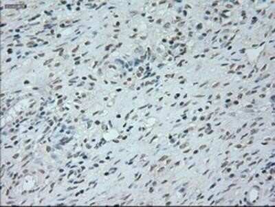 Immunohistochemistry: Neurogenin-1 Antibody (OTI3F9) - Azide and BSA Free [NBP2-72948]