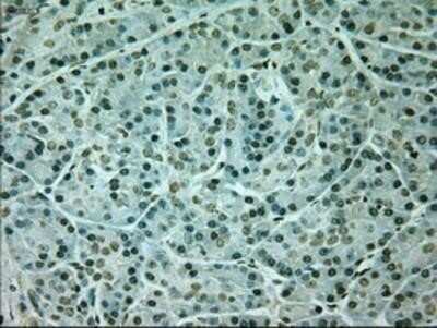 Immunohistochemistry: Neurogenin-1 Antibody (OTI3F9) - Azide and BSA Free [NBP2-72948]