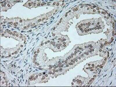 Immunohistochemistry-Paraffin: Neurogenin-1 Antibody (OTI3F9) [NBP1-47871]