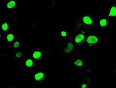 Immunocytochemistry/ Immunofluorescence: Neurogenin-3 Antibody (OTI3B5) [NBP1-47878]