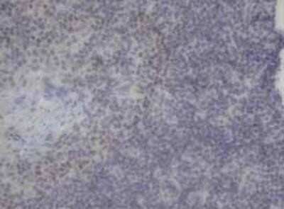 Immunohistochemistry-Paraffin: Neurogenin-3 Antibody (OTI3B5) [NBP1-47878]