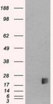 Western Blot: Neurogenin-3 Antibody (OTI3B5) [NBP1-47878]