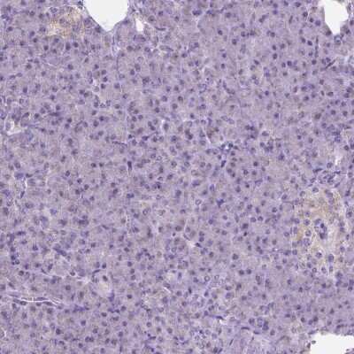 Immunohistochemistry-Paraffin: Neuroglycan C/CSPG5 Antibody [NBP2-49669]