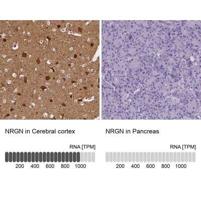 Immunohistochemistry-Paraffin: Neurogranin Antibody [NBP2-32655]