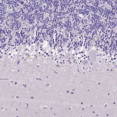 Immunohistochemistry-Paraffin: Neurogranin Antibody [NBP2-32655]