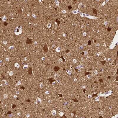 Immunohistochemistry-Paraffin: Neurogranin Antibody [NBP2-32655]