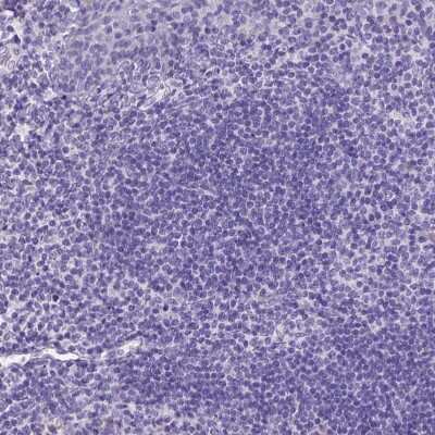 Immunohistochemistry-Paraffin: Neurogranin Antibody [NBP2-32655]