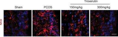 Immunohistochemistry: Neurokinin B Antibody - BSA Free [NB300-201]