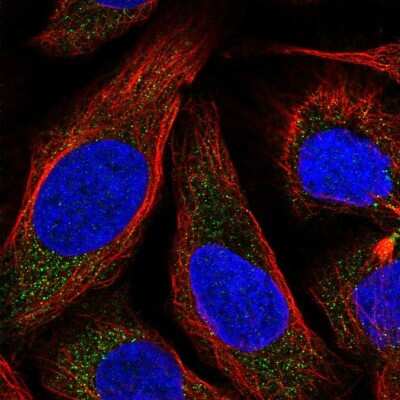 Immunocytochemistry/ Immunofluorescence: Neurokinin B Antibody [NBP1-92178]