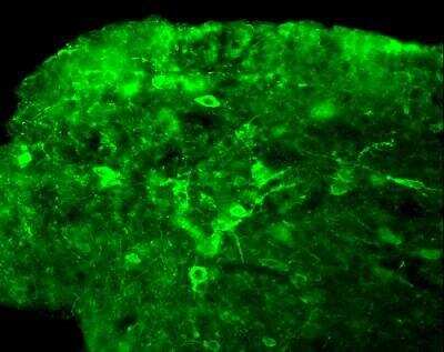 Immunohistochemistry: Neurokinin B Antibody - BSA Free [NB300-201]