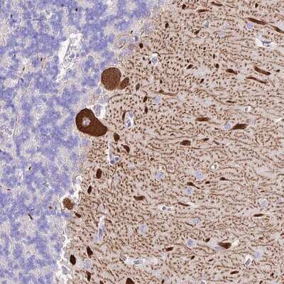 Immunohistochemistry-Paraffin: Neurokinin B Antibody [NBP1-92178]