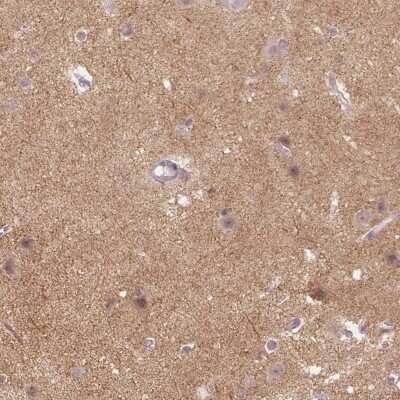 Immunohistochemistry-Paraffin: Neuroligin 2/NLGN2 Antibody [NBP2-49590]