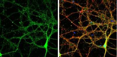Immunocytochemistry/ Immunofluorescence: Neuroligin 3/NLGN3 Antibody [NBP3-12987]