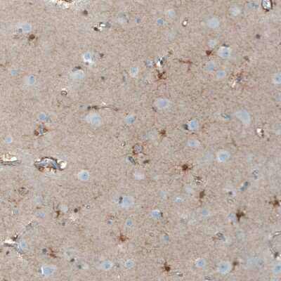 Immunohistochemistry-Paraffin: Neuroligin 3/NLGN3 Antibody [NBP1-90080]