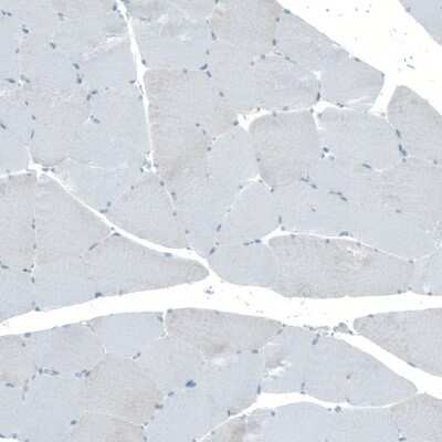 Immunohistochemistry-Paraffin: Neuroligin 3/NLGN3 Antibody [NBP1-90080]