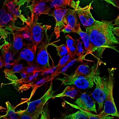 Immunocytochemistry/ Immunofluorescence: Neuroligin 3/NLGN3 Antibody (S110-29) [NBP2-42200]