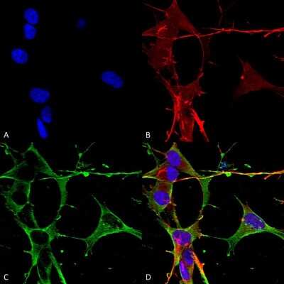 Immunocytochemistry/ Immunofluorescence: Neuroligin 3/NLGN3 Antibody (S110-29) [NBP2-42200]