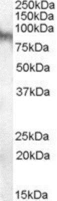 Western Blot: Neuroligin 3/NLGN3 Antibody [NB100-79866]