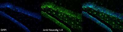 Immunocytochemistry/ Immunofluorescence: Neuroligin 4X/NLGN4X Antibody (S98-7) [NBP2-42198]