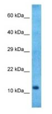 Western Blot: Neuromedin B Antibody [NBP3-09269]