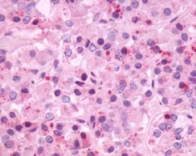 Immunohistochemistry: Neuromedin BR/NMBR Antibody - BSA Free [NLS828]