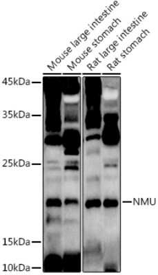 Western Blot: Neuromedin-U AntibodyAzide and BSA Free [NBP2-94527]