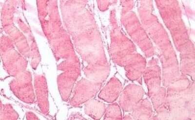 Immunohistochemistry-Paraffin: Neuromedin UR2/NMUR2 Antibody - BSA Free [NBP1-02351]