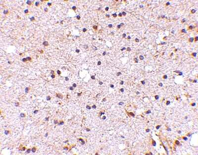 Immunohistochemistry-Paraffin: Neuronal Pentraxin 2 Antibody - BSA Free [NBP1-76899]