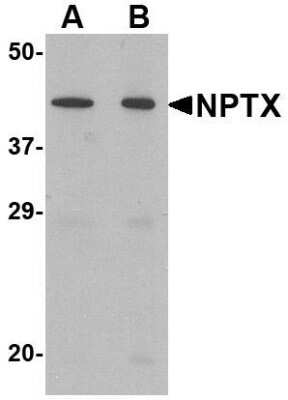 Western Blot: Neuronal Pentraxin 2 AntibodyBSA Free [NBP1-76899]
