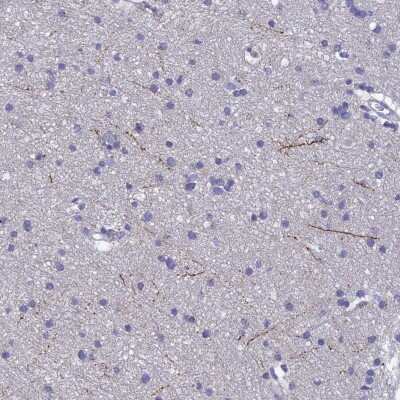 Immunohistochemistry-Paraffin: Neuropeptide Y Antibody [NBP2-33423]