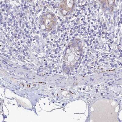 Immunohistochemistry-Paraffin: Neuropeptide Y Antibody [NBP2-33423]