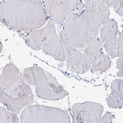Immunohistochemistry-Paraffin: Neuropeptide Y Antibody [NBP2-33423]