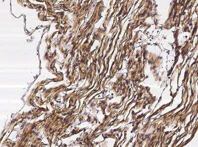 Immunohistochemistry-Paraffin: Neuropilin-1 Antibody (042) [NBP2-89197]