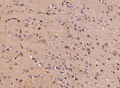Immunohistochemistry-Paraffin: Neuropilin-1 Antibody (042) [NBP2-89197]