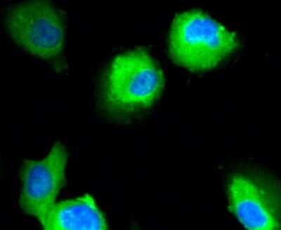 Immunocytochemistry/ Immunofluorescence: Neuropilin-1 Antibody (ST05-30) [NBP2-67539]