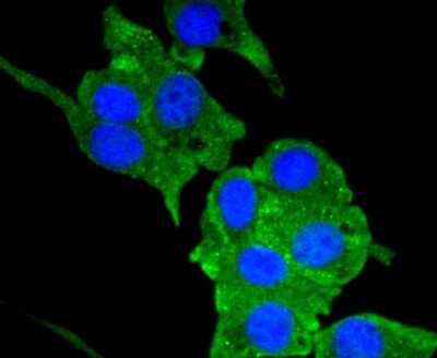 Immunocytochemistry/ Immunofluorescence: Neuropilin-1 Antibody (ST05-30) [NBP2-67539]