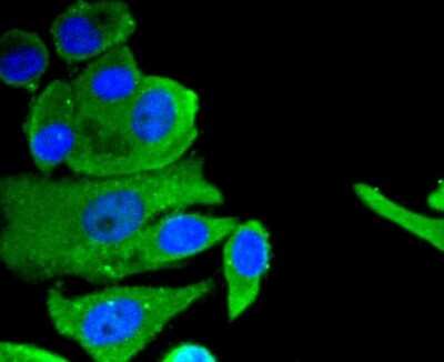 Immunocytochemistry/ Immunofluorescence: Neuropilin-1 Antibody (ST05-30) [NBP2-67539]