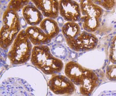 Immunohistochemistry-Paraffin: Neuropilin-1 Antibody (ST05-30) [NBP2-67539]