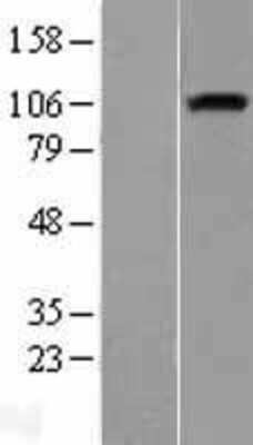 Western Blot: Neuropilin-1 Overexpression Lysate [NBL1-13798]
