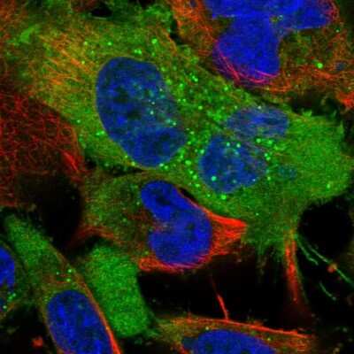 Immunocytochemistry/ Immunofluorescence: Neuropilin-2 Antibody [NBP2-58804]