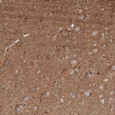 Immunohistochemistry-Paraffin: Neuropilin-2 Antibody [NBP1-86866]
