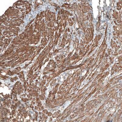 Immunohistochemistry-Paraffin: Neuropilin-2 Antibody [NBP1-86866]