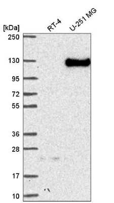 Western Blot: Neuropilin-2 Antibody [NBP2-58804]